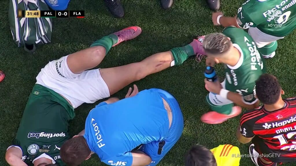 Imagem mostra perna de Bruno Fuchs após pisão de Erick Pulgar - Reprodução/GETV