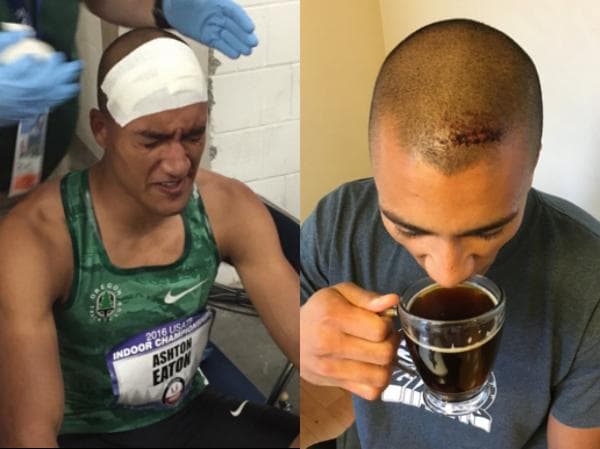 Ashton Eaton postou fotos do machucado em sua cabeça no Tiwtter