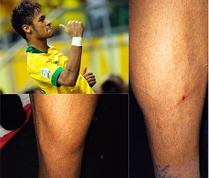 Neymar: em rede social, as marcas das faltas