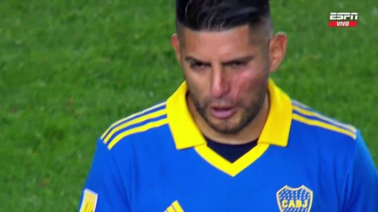 Machucado em Zambrano após discussão com Benedetto chamou a atenção em jogo do Boca -