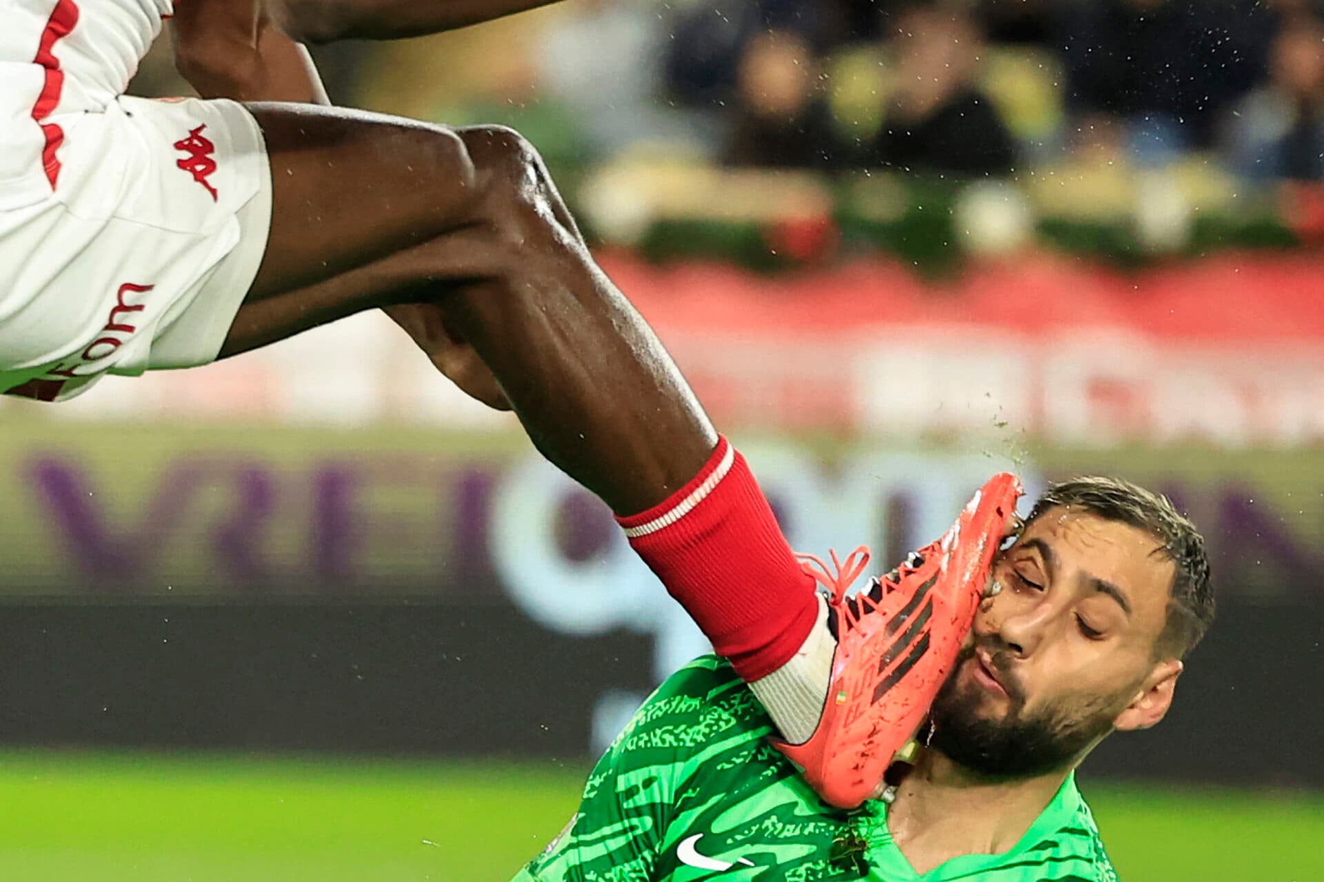 Donnarumma sofre solada forte no rosto em PSG x Monaco