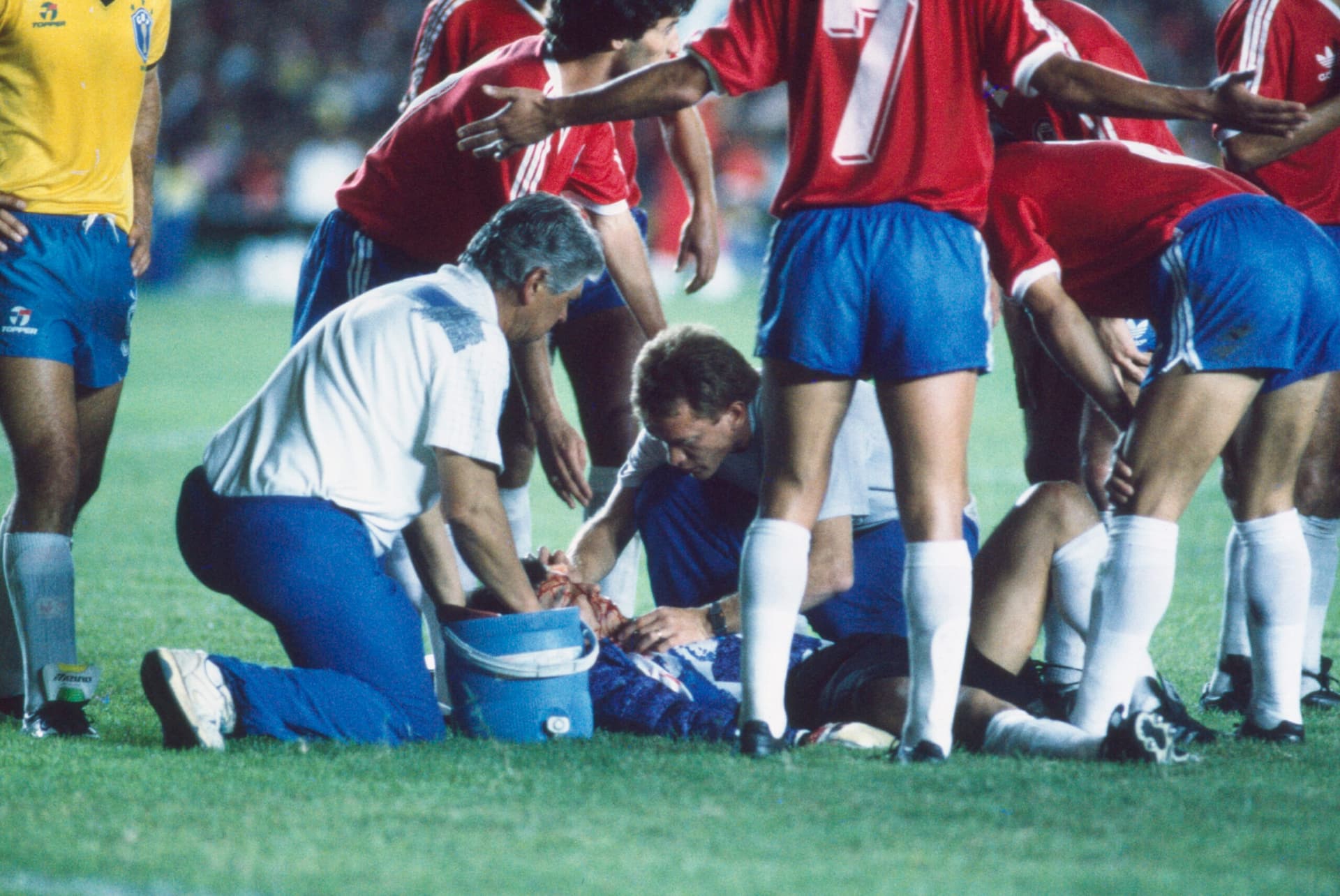 Roberto Antonio Rojas, goleiro do Chile, após ser supostamente atingido por um sinalizador da marinha, no jogo contra o Brasil, durante a eliminatória para Copa do Mundo de 1990, no estádio do Maracanã (PLACAR)