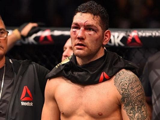 Chris Weidman postou em seu Instagram uma foto de seu rosto machucado após nocaute de Luke Rockhold
