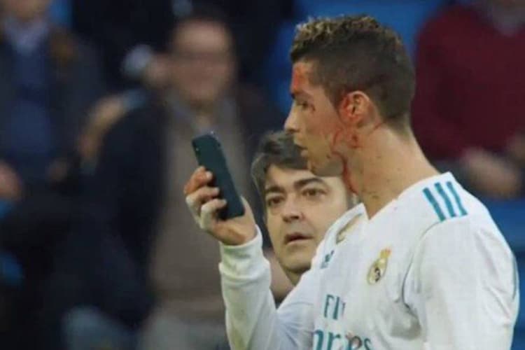 Cristiano Ronaldo observa corte no supercílio pelo celular