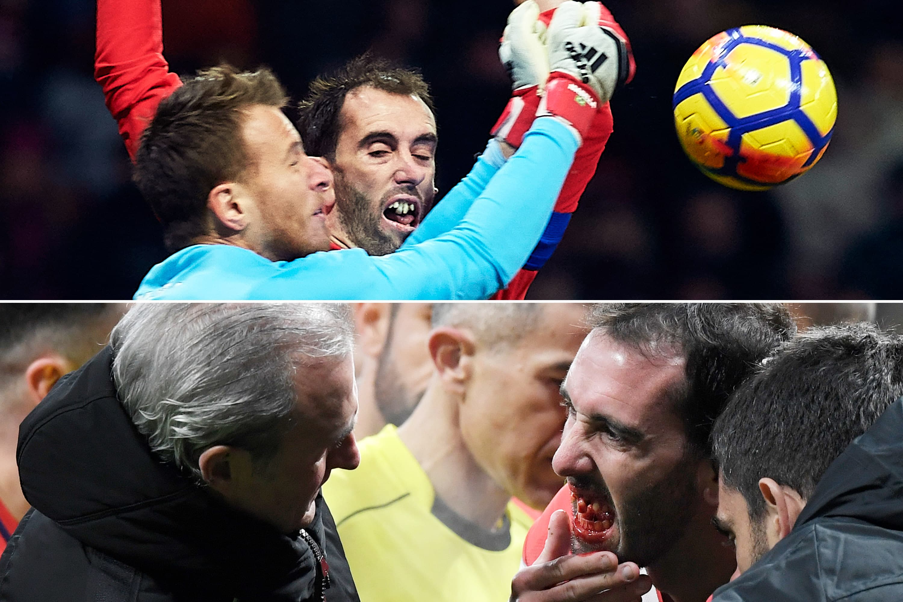 Diego Godín perde o dente em dividida