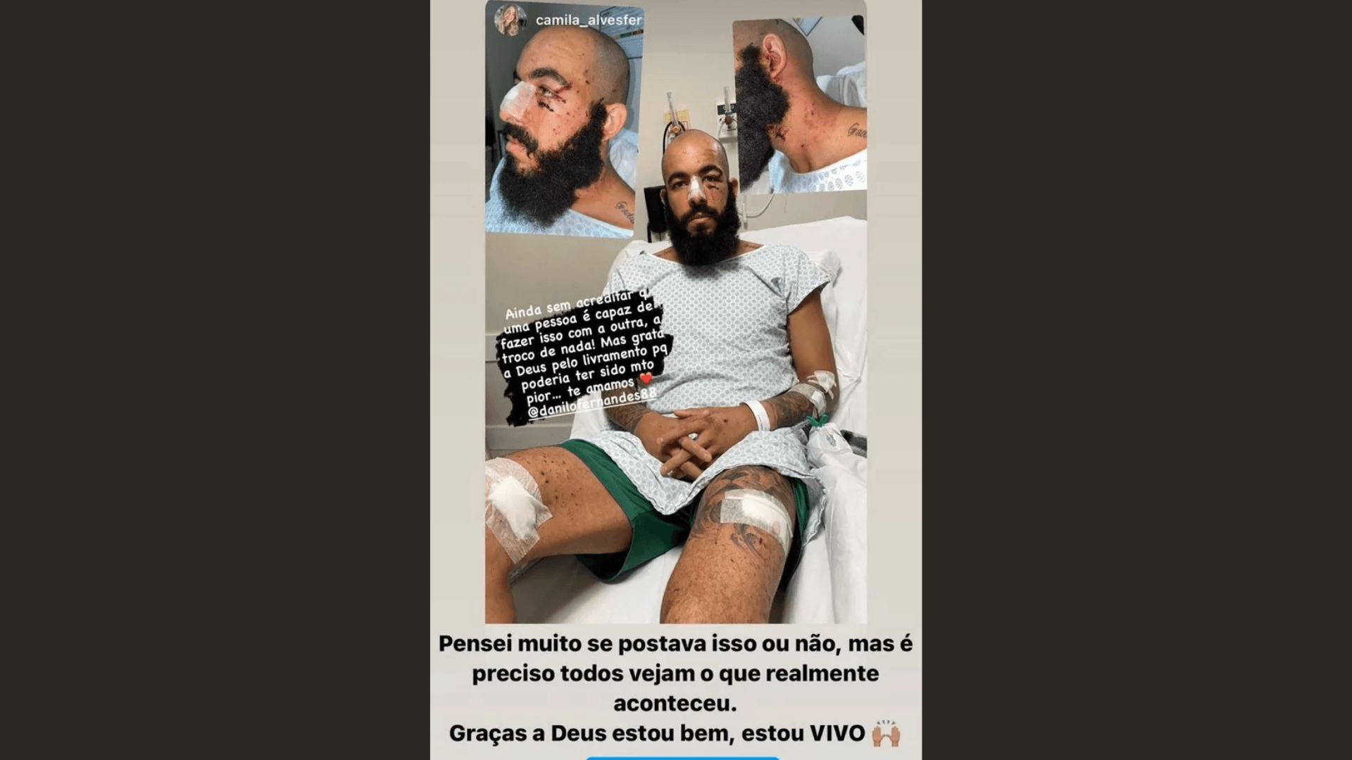 Danilo Fernandes no hospital após ataque a onibus do Bahia