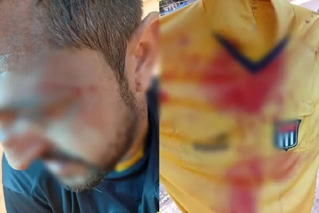 Árbitro é agredido por pais e atletas em jogo sub-14 em SP