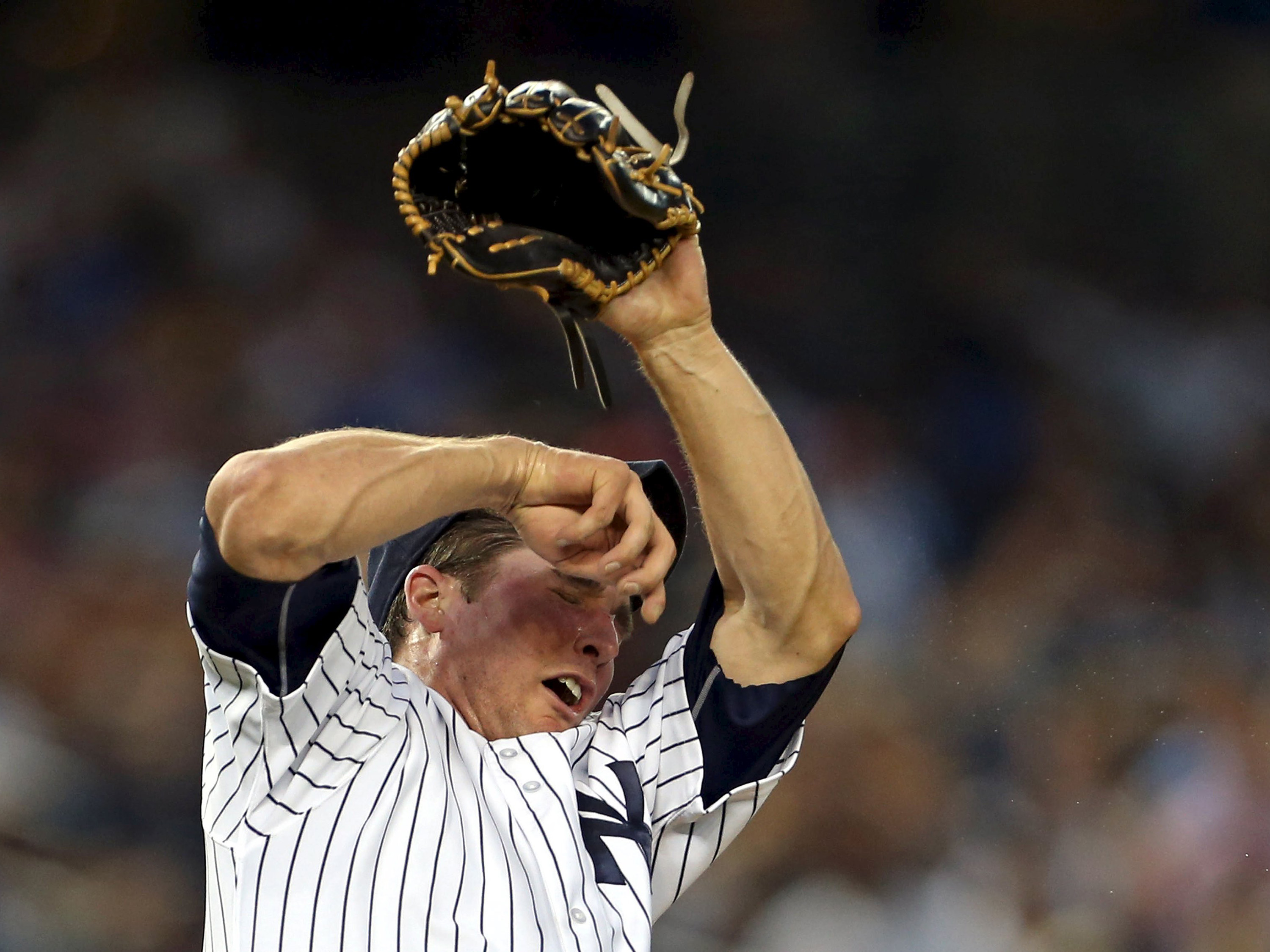 Beisebol: Jogador do Yankees fratura nariz ao levar bolada