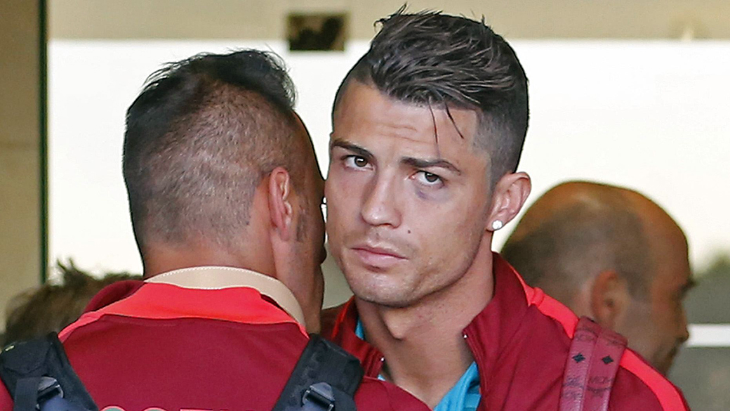 Cristiano Ronaldo retorna a Portugal com olho roxo