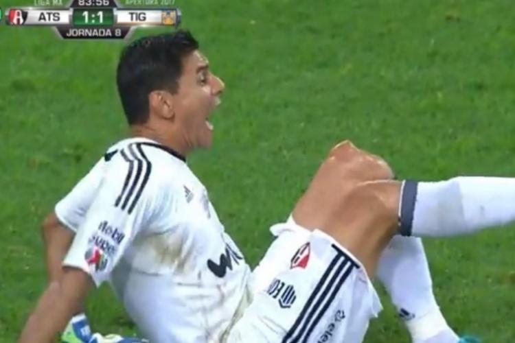 Vídeo: goleiro argentino sofre lesão chocante no México