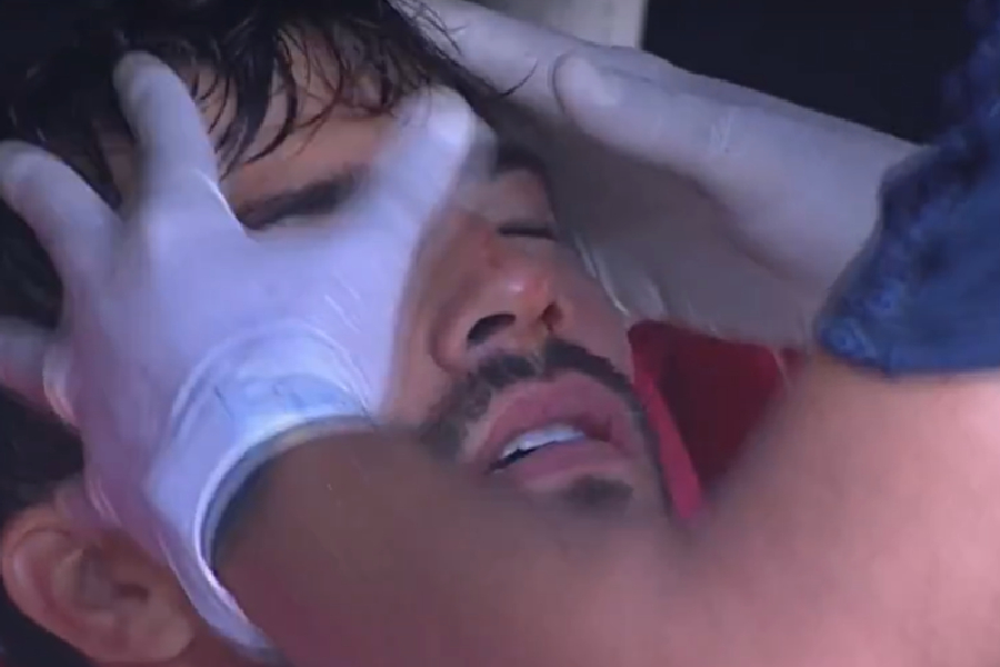 Lucas Silva saiu de campo com sangramento na boca e no nariz -