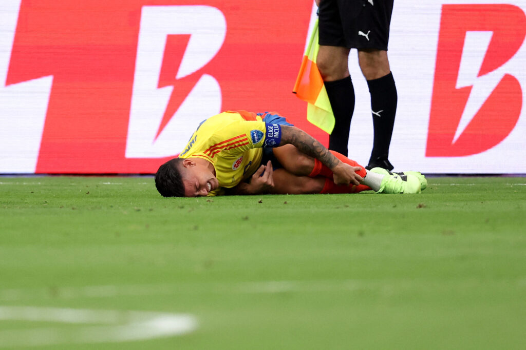 Camisa 10 colombiano se queixou de dores no tornozelo após sofrer entrada - Chris Coduto/AFP